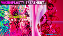 Charger l&#39;image dans la galerie, ★Natural VaginoPlasty Treatment★ - SPIRILUTION.COM
